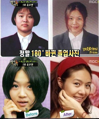 Trước khi thẩm mĩ