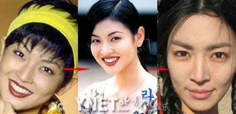 Kim So Yeon thời đeo băng đô khiến người khác Kim So Yeon thời đeo băng đô khiến người khác